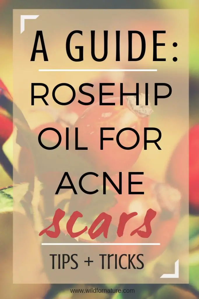  rosehip oil for acne scars