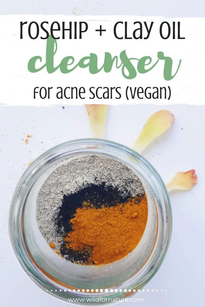 Aztec Healing Clay Acne Scars oil cleanser